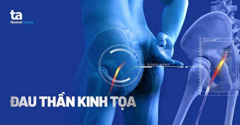 Minh họa chi tiết cơ bắp lưng dưới và phần eo trong cách vẽ dáng người sau lưng chính xác và nghệ thuật