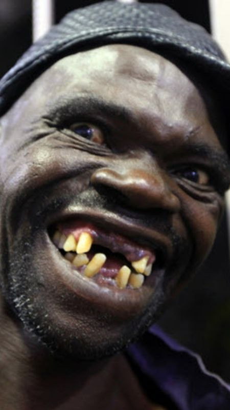 Ảnh trai xấu nước ngoài với nụ cười độc đáo