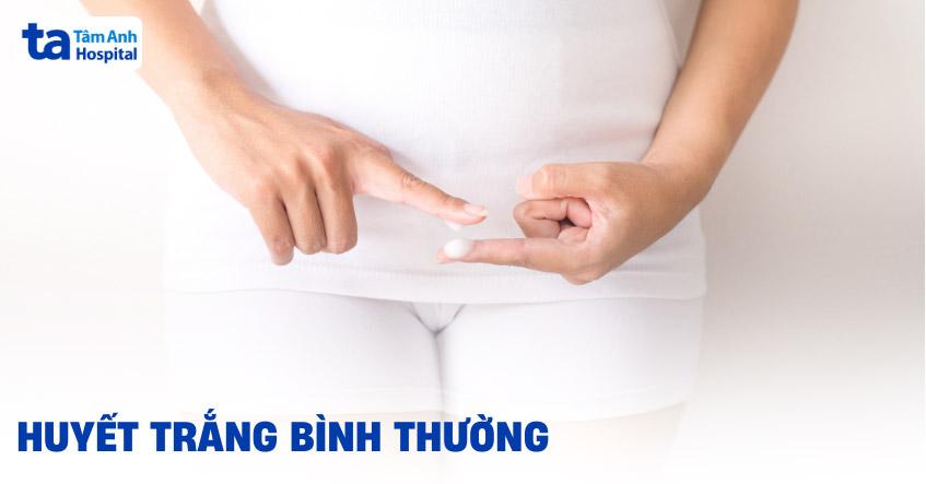 Hình ảnh minh họa các biến đổi màu sắc có thể gặp của dịch sinh lý nữ, bao gồm các sắc thái bất thường