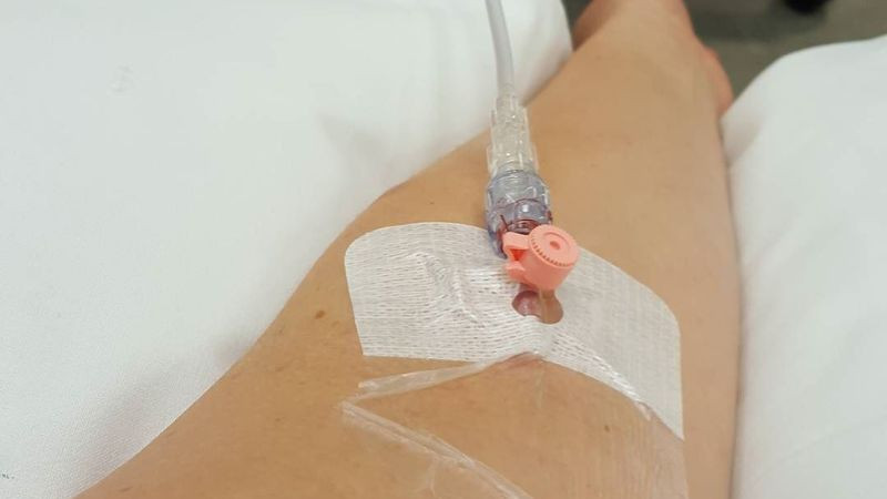 Hình ảnh cận cảnh đầu kim ven truyền nước