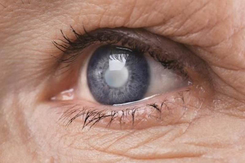 Hình ảnh mô phỏng đôi mắt với các lớp cấu tạo, tập trung vào võng mạc và thủy tinh thể