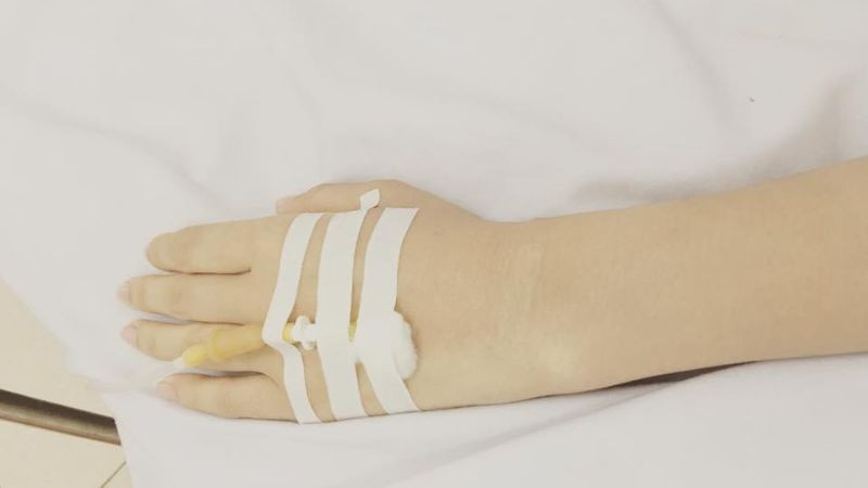 Hình ảnh truyền dịch trên cánh tay của bệnh nhân nữ