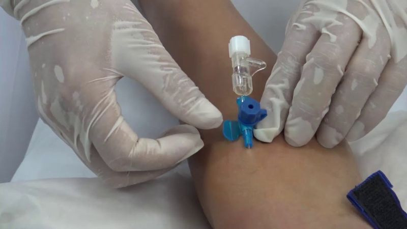 Hình ảnh y bác sĩ đưa ống dẫn dịch vào tay bệnh nhân