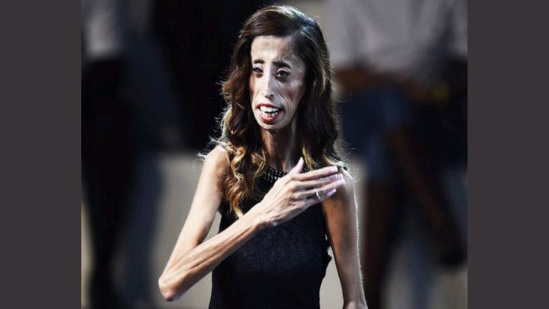 Lizzie Velasquez truyền cảm hứng cho khán giả