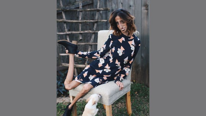 Lizzie Velasquez với nụ cười rạng rỡ