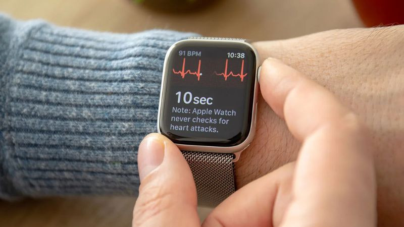 Màn hình đồng hồ thông minh hiển thị biểu đồ điện tâm đồ ECG chi tiết