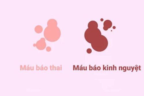 Hinh anh minh hoa sac thai mau hong nhat cua mau bao kinh nguyet som