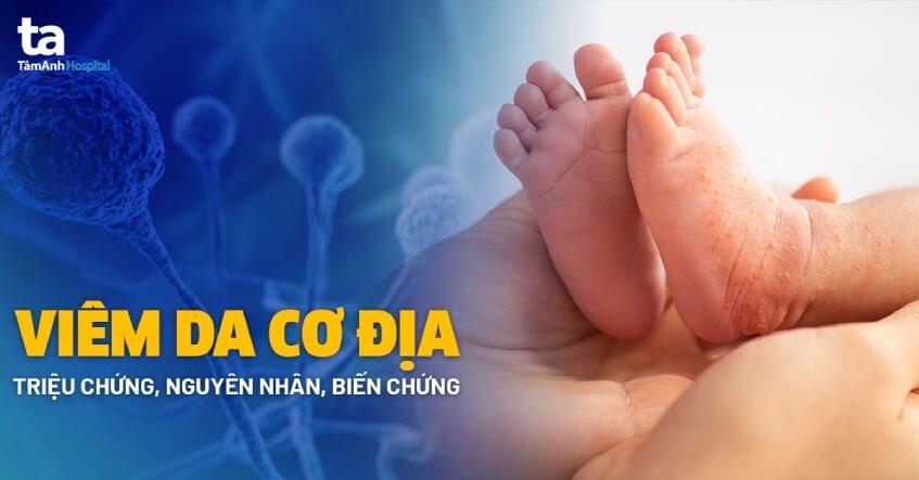 Giải mã hiện tượng uống bia mặt trắng là nhóm máu gì Hinh anh mo ta su da dang ve phan ung cua co the gay mat trang do co dia khi uong bia