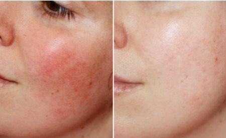 Màu Xanh Lá: Sắc Tẩy Trang Bioderma Cho Da Dầu Mụn Khám phá ý nghĩa màu xanh lá trong nghệ thuật, liên hệ tẩy trang bioderma cho da dầu mụn màu gì