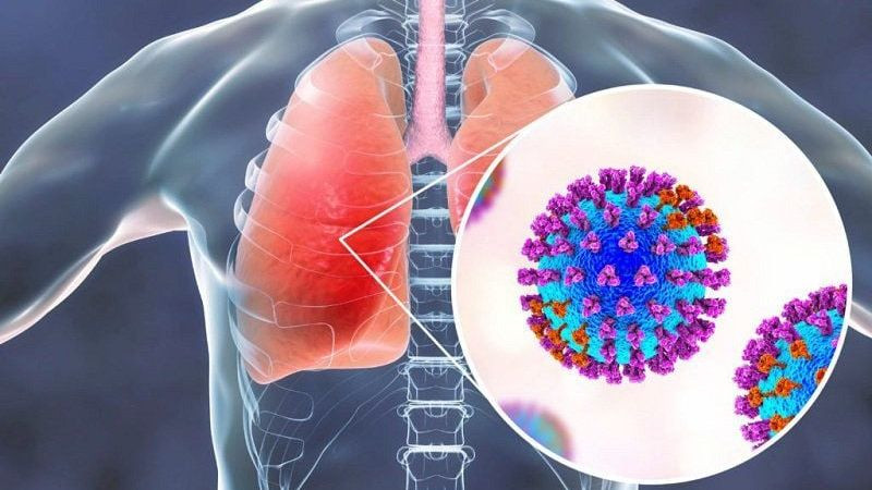 Viêm VA Là Gì? Triệu Chứng, Nguyên Nhân Và Cách Điều Trị Hiệu Quả