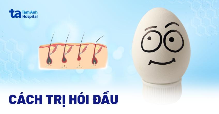 Cách Vẽ Tóc Con Trai: Hướng Dẫn Toàn Diện Cho Người Mới Phác thảo các hướng đi cơ bản của tóc nam và cách chia mảng tóc lớn khi vẽ tóc con trai