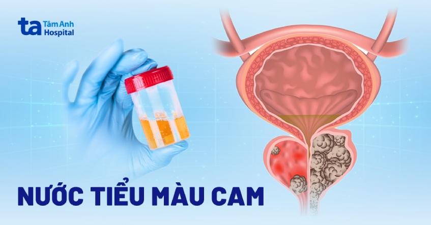 Cảnh vật liệu và bảng màu với màu đỏ, vàng, cam cà rốt đã pha