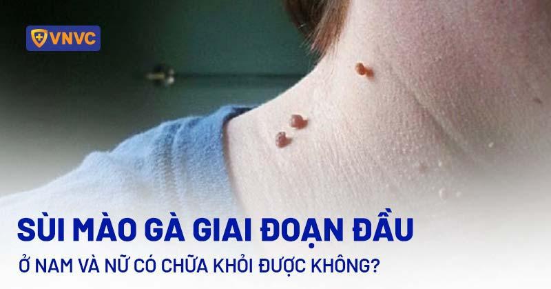 Hình ảnh minh họa sự phức tạp của màu sắc, bắt nguồn từ câu hỏi sùi mào gà có màu gì và cách ánh sáng ảnh hưởng sắc thái