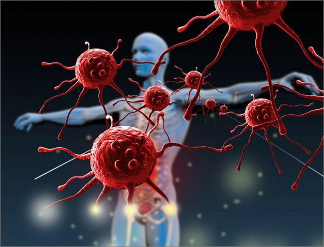 Minh họa bão Cytokine: Phản ứng miễn dịch bùng phát và giải phóng lượng lớn cytokine gây viêm hệ thống