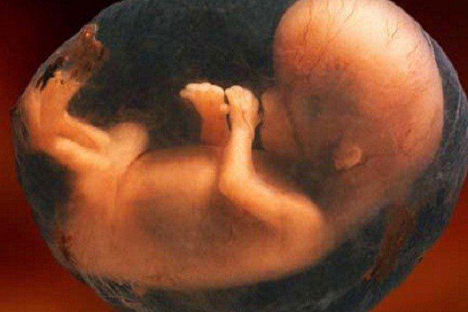 Nước ối sắp sinh có màu gì - Nước ối màu xanh rêu