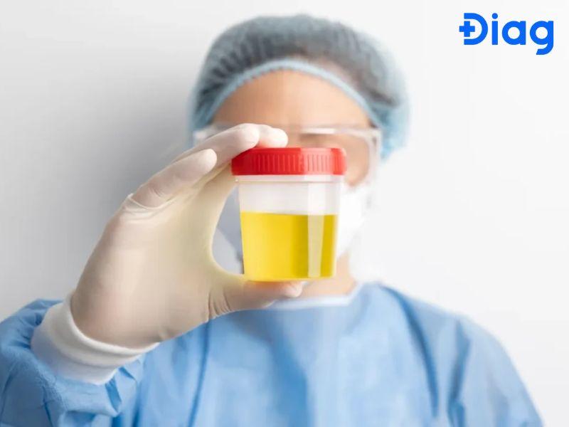 Que thử glucose hiện màu, minh họa sắc thái khi phát hiện đường trong mẫu